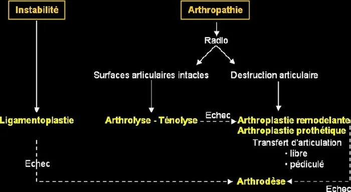Arthroplastie — figure 1