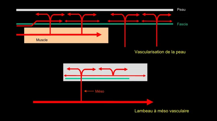 Principe du lambeau à méso vasculaire