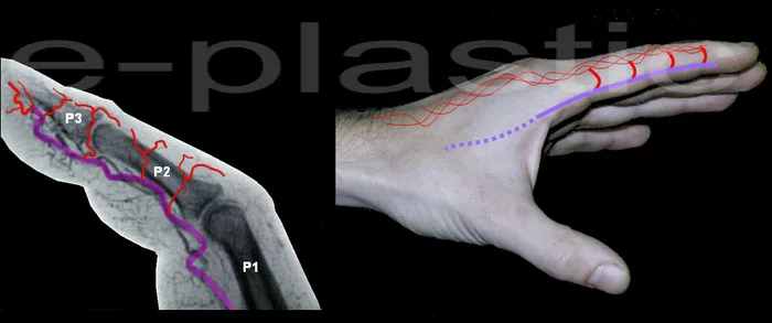 Réseau artériel sous-cutané dorsal anastomosé à mi-P1, mi-P2 et base de P3