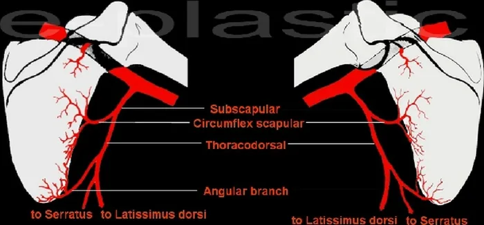 Lambeau de crête de scapula — figure 4