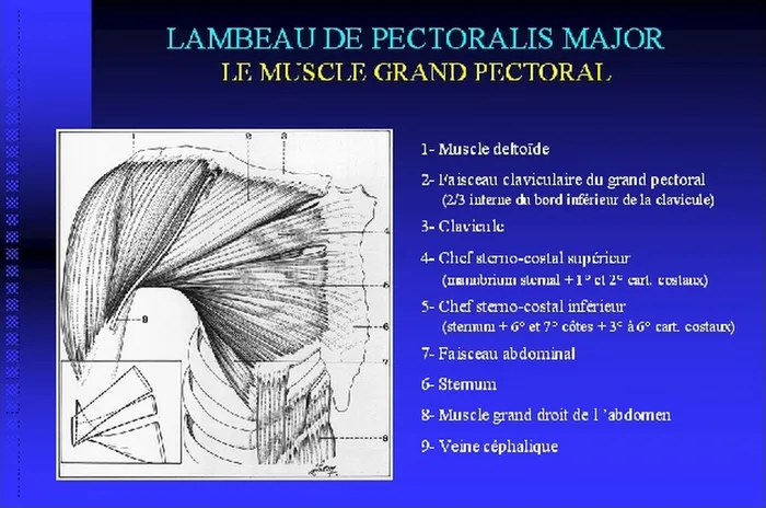 Lambeau de pectoralis major — figure 4