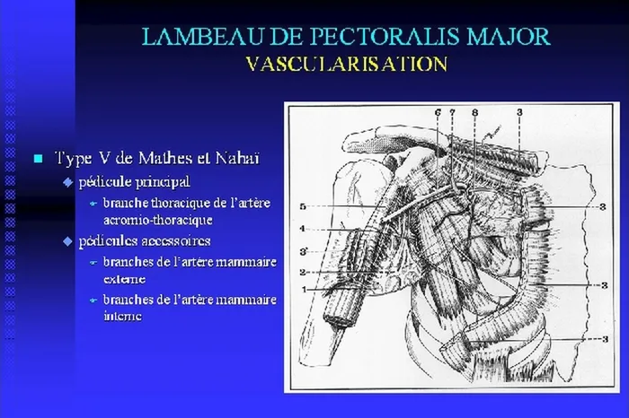 Lambeau de pectoralis major — figure 6