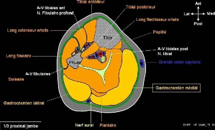 Lambeau de muscle gastrocnémien médial — figure 5