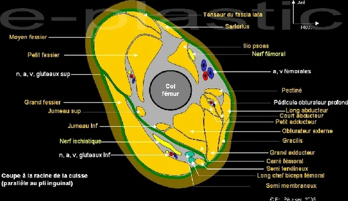 Lambeau inguinal cutané — figure 2