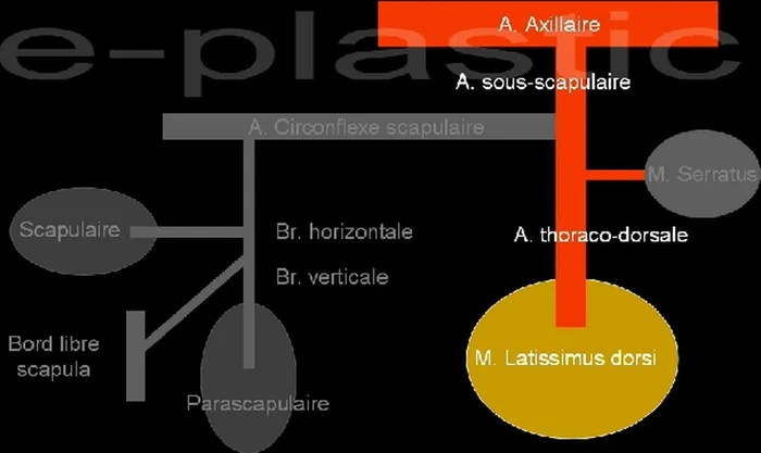 Lambeau de latissimus dorsi — figure 3