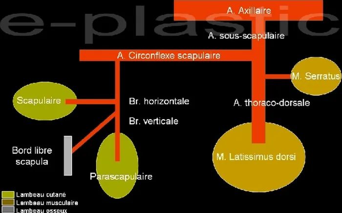 Lambeau parascapulaire — figure 1