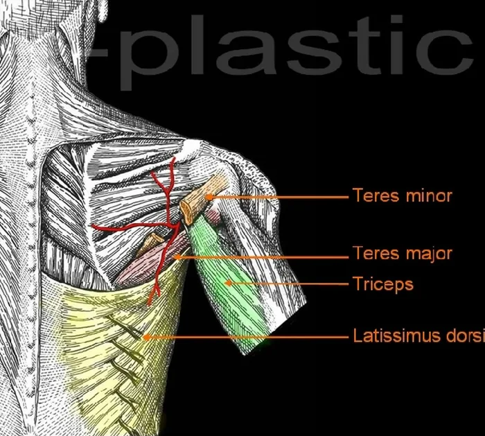 Lambeau parascapulaire — figure 4