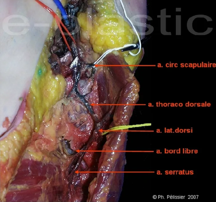Lambeau parascapulaire — figure 7