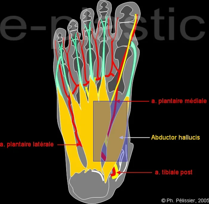 Lambeau plantaire interne — figure 3