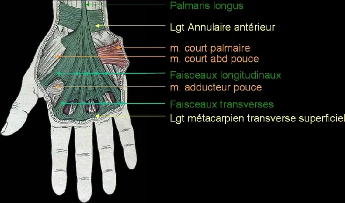 Maladie de Dupuytren — figure 5