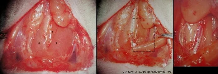 Micro-anastomoses vasculaires — figure 3