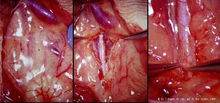 Micro-anastomoses vasculaires — figure 5