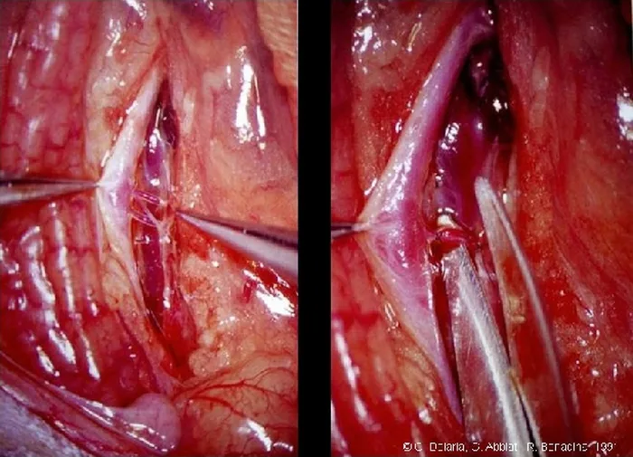 Micro-anastomoses vasculaires — figure 6