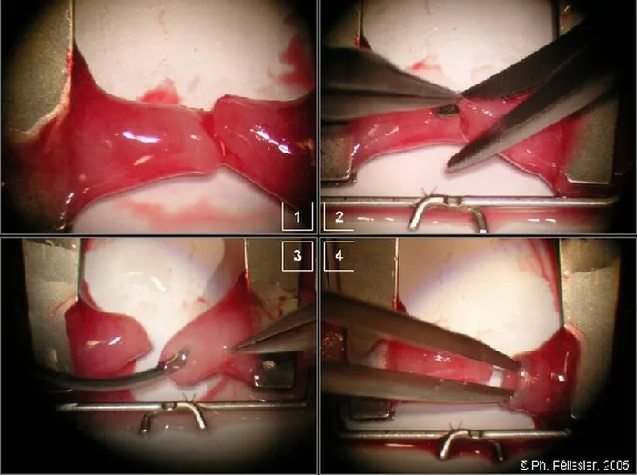 Micro-anastomoses vasculaires — figure 8