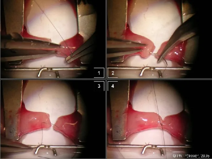 Micro-anastomoses vasculaires — figure 9