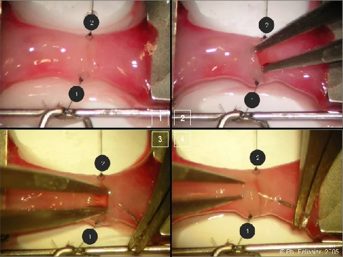 Micro-anastomoses vasculaires — figure 10