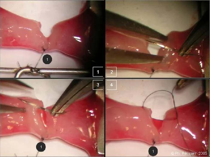 Micro-anastomoses vasculaires — figure 11
