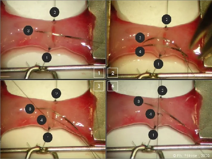 Micro-anastomoses vasculaires — figure 12
