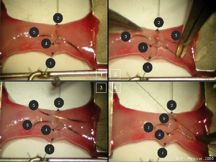 Micro-anastomoses vasculaires — figure 13