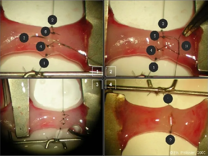 Micro-anastomoses vasculaires — figure 14