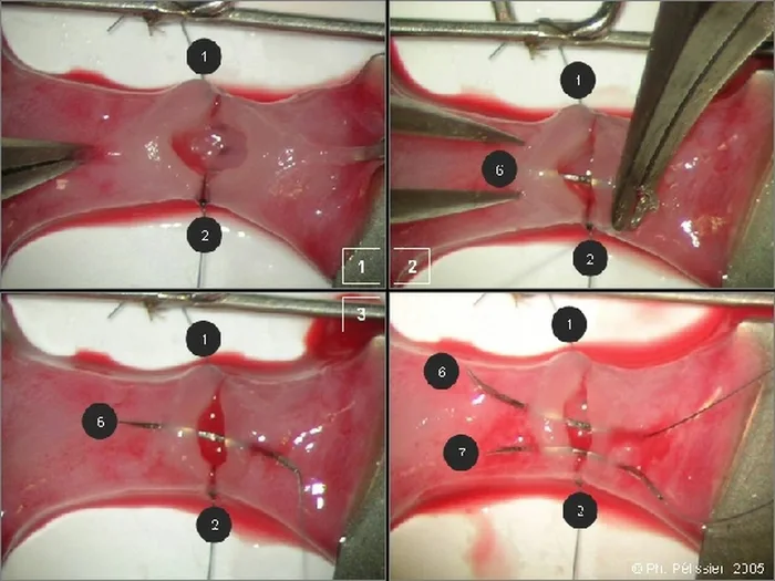 Micro-anastomoses vasculaires — figure 15