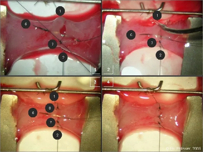 Micro-anastomoses vasculaires — figure 16