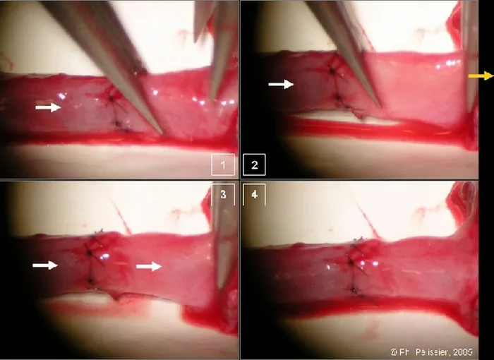 Micro-anastomoses vasculaires — figure 17