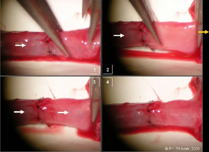 Micro-anastomoses vasculaires — figure 18